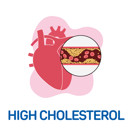 High Cholesterol