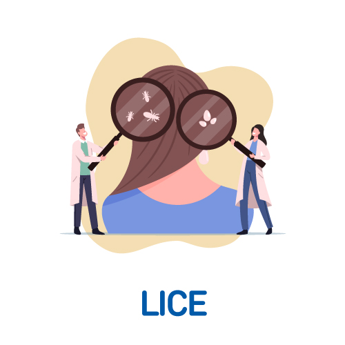 Lice