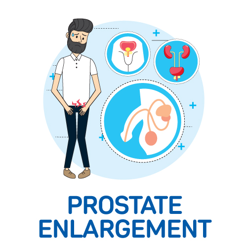 Prostate Enlargement