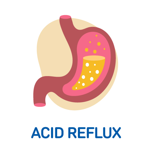 Acid Reflux