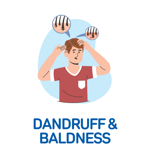 Dandruff & Baldness