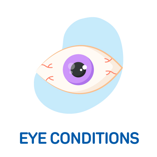 Eye Conditions