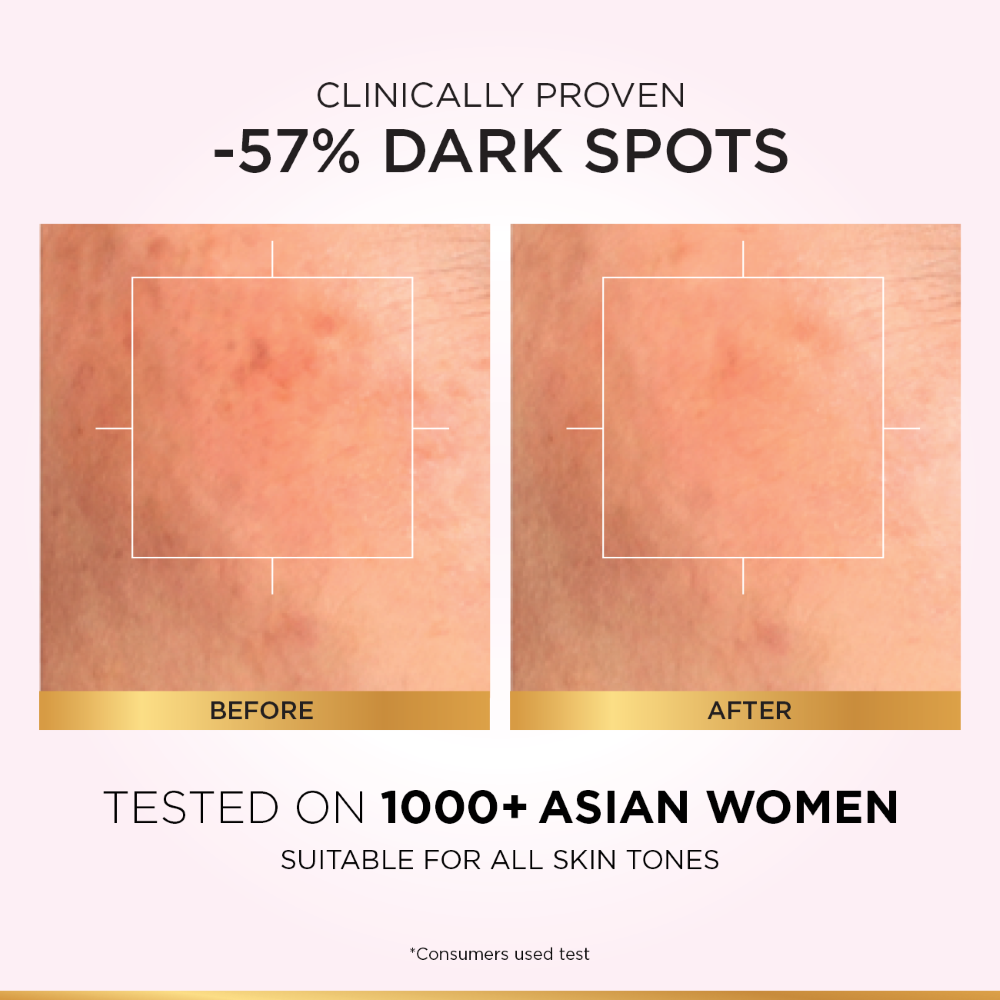 L'Oreal Paris Glycolic Bright Instant Glowing Serum, Reduces 57% Dark ...