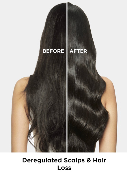 loreal professionnel scalp advanced